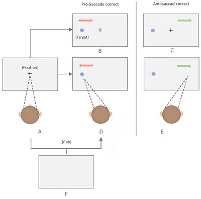 Anti-saccade as a Tool to Evaluate Neurocognitive Impairment in Alcohol Use Disorder